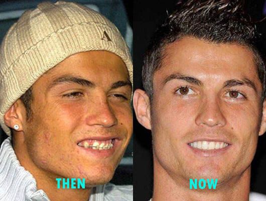 Có ai khác trong làng thể thao đã niềng răng như Ronaldo?
