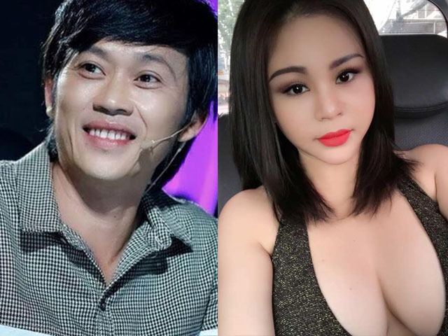 'Nữ danh hài được Hoài Linh đòi cưới' tiết lộ lý do không sửa mũi dù nghiện 'dao kéo'
