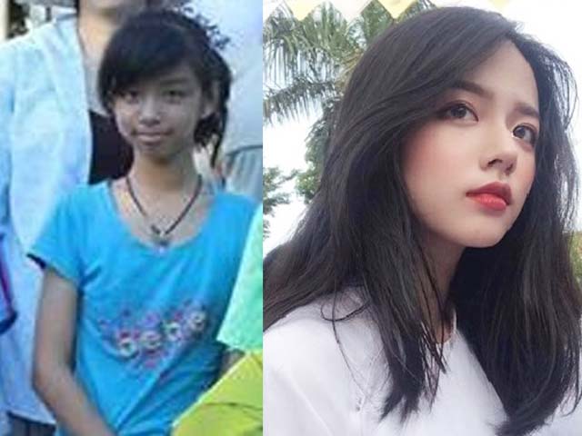 Nữ sinh Quảng Bình gầy đen, ốm o bỗng xinh lên kinh ngạc đến mức bị đồn "dao kéo"