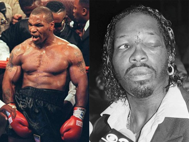 Ăn đấm của Mike Tyson, đòi 25 triệu USD: Kẻ ngông cuồng ôm hận ngàn năm - 1