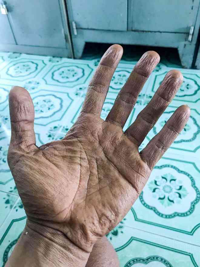 Xúc động chùm ảnh cảnh sát chữa cháy bị bỏng, ăn, ngủ tại hiện trường - 7