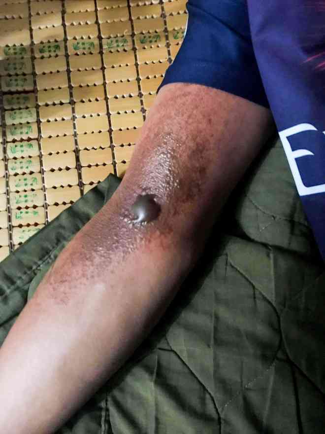 Xúc động chùm ảnh cảnh sát chữa cháy bị bỏng, ăn, ngủ tại hiện trường - 8