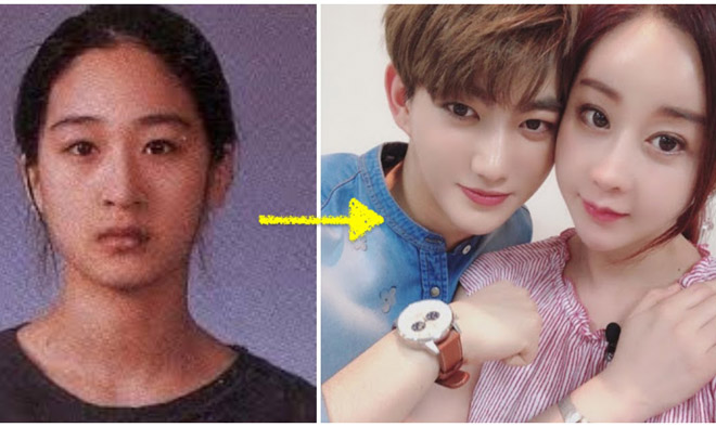 Sao "Tình dục là chuyện nhỏ" 42 tuổi lấy trai 24, 5 lần sửa mũi để đổi vận - 4