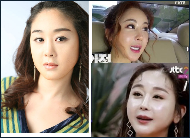 Sao "Tình dục là chuyện nhỏ" 42 tuổi lấy trai 24, 5 lần sửa mũi để đổi vận - 8