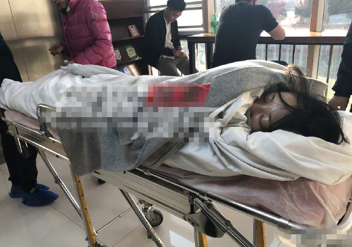 "Tiểu Long Nữ gợi cảm nhất màn ảnh" khoe... nách để phủ nhận nâng vòng 1 - 7