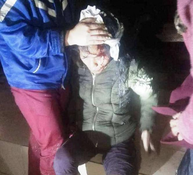 Lốc xoáy tàn phá miền núi Nghệ An, cụ bà bị nhà sập đè gãy chân - 2