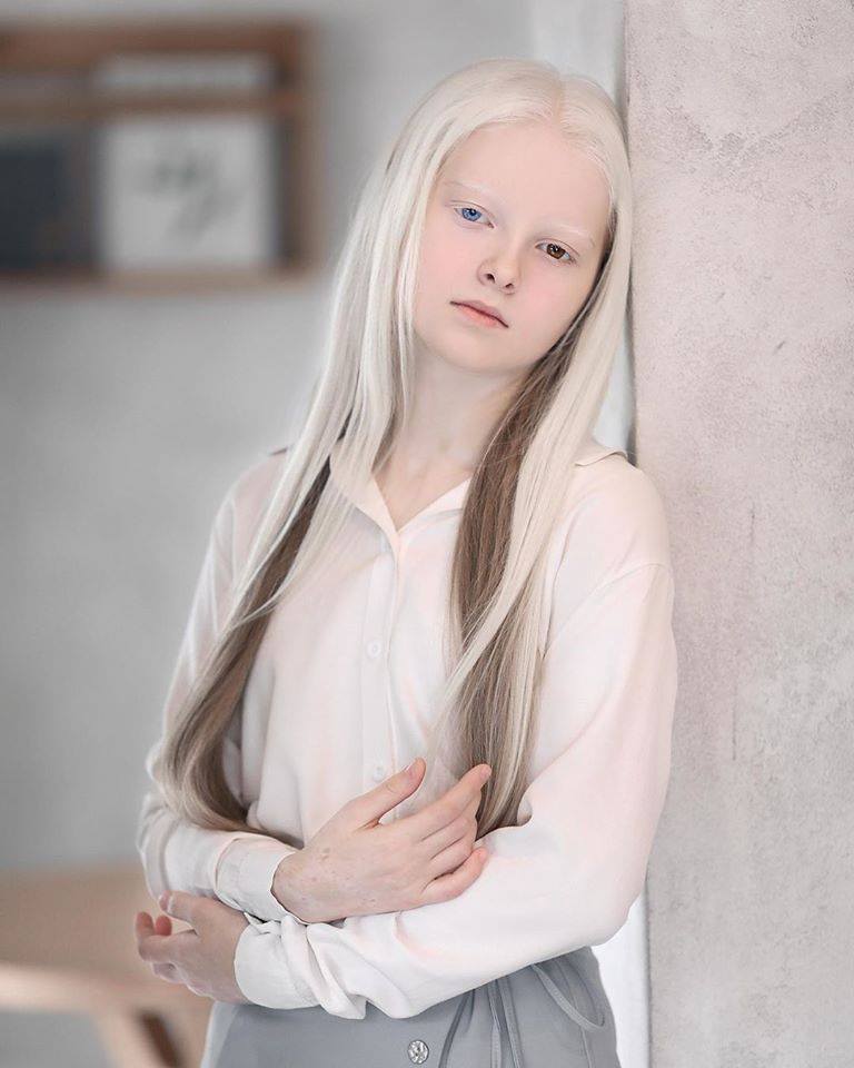 Cô gái Nga bị đột biến gen có đôi mắt hai màu, đẹp như tác phẩm nghệ thuật - 3
