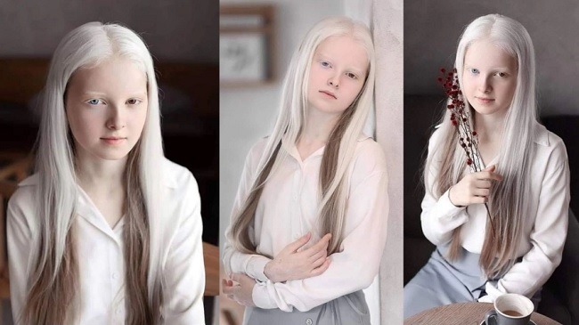 Cô gái Nga bị đột biến gen có đôi mắt hai màu, đẹp như tác phẩm nghệ thuật - 1