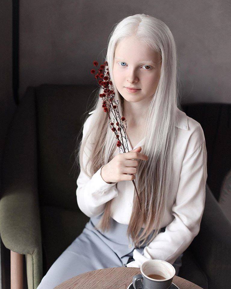 Cô gái Nga bị đột biến gen có đôi mắt hai màu, đẹp như tác phẩm nghệ thuật - 4