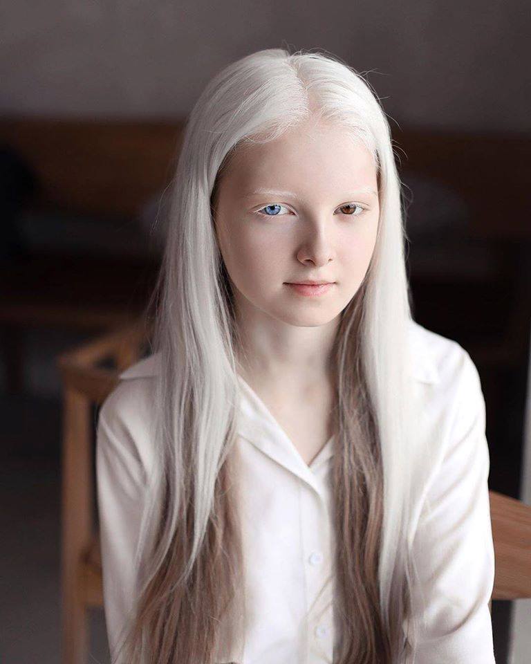 Cô gái Nga bị đột biến gen có đôi mắt hai màu, đẹp như tác phẩm nghệ thuật - 2