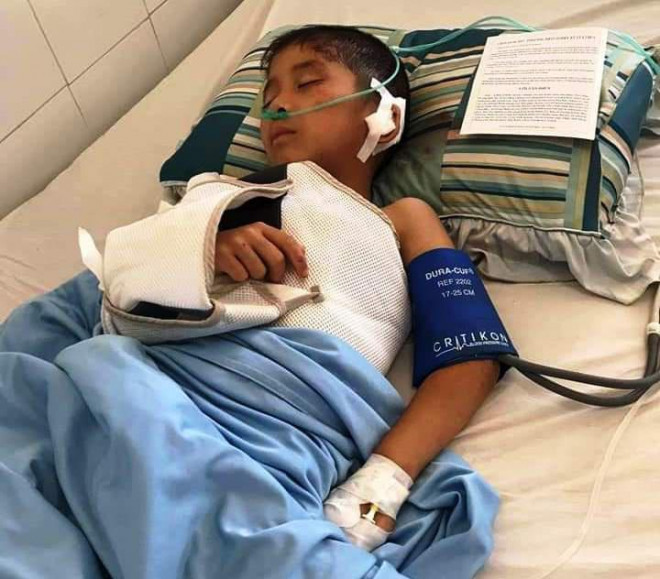 Bị xe trước tông ngã xuống đường, xe sau cán phải, 2 người đi xe máy chết tại chỗ - 2