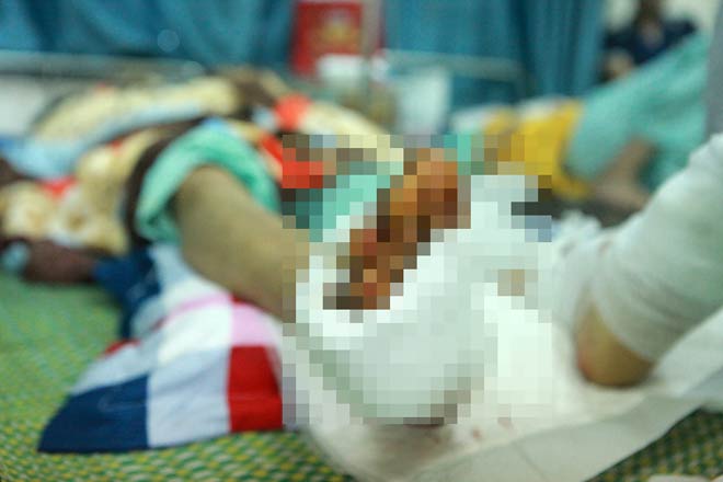 Nạn nhân vụ lốc xoáy ở Vĩnh Phúc: “Tôi ôm cánh tay lủng lẳng, đầy máu chạy trong mưa” - 4