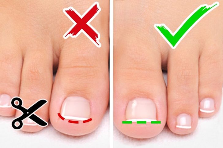 3 nguyên tắc giúp bạn có đôi bàn chân ngọc ngà đẹp như mơ ước - 3