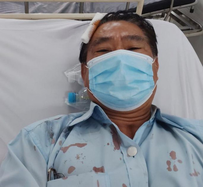 Ô tô cán bộ cơ sở cai nghiện Bình Triệu bị tạt sơn - 2