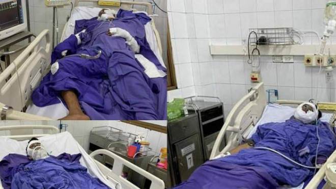 Nổ bình ga, cháy tàu ở Vân Đồn: Ba anh em ruột nguy kịch, gia cảnh khó khăn - 2