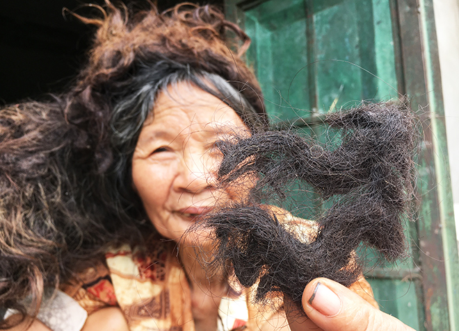 Người phụ nữ có mái tóc kì dị: Kết thành nhiều mảng, cứ cắt là đổ bệnh - 7