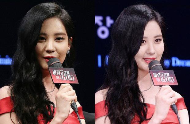 Tiền bạc, mỹ phẩm không thiếu nhưng vì sao idol K-Pop thường khó thoát được làn da mụn? - 5