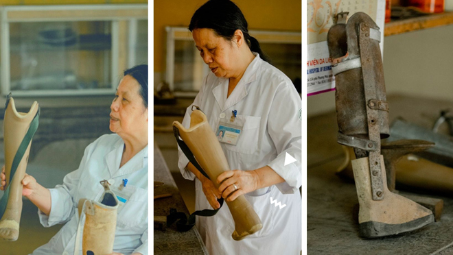 Người đàn bà “điên” dành cả thanh xuân để thương người mắc bệnh chân, tay cụt dần - 3