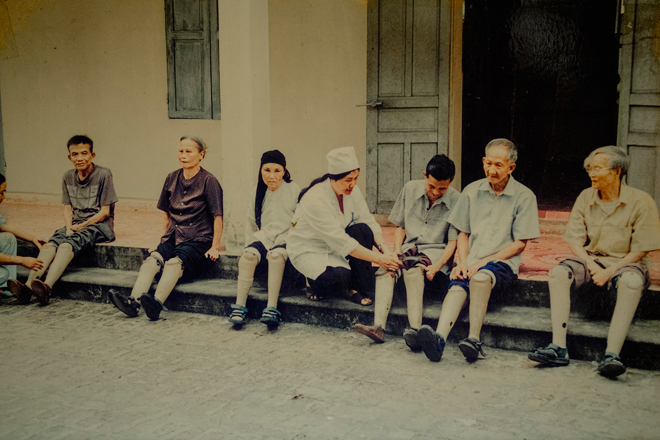 Người đàn bà “điên” dành cả thanh xuân để thương người mắc bệnh chân, tay cụt dần - 5