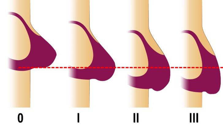 Cách xử lý đồ dùng thân quen trong gia đình để trẻ đẹp dài lâu - 6