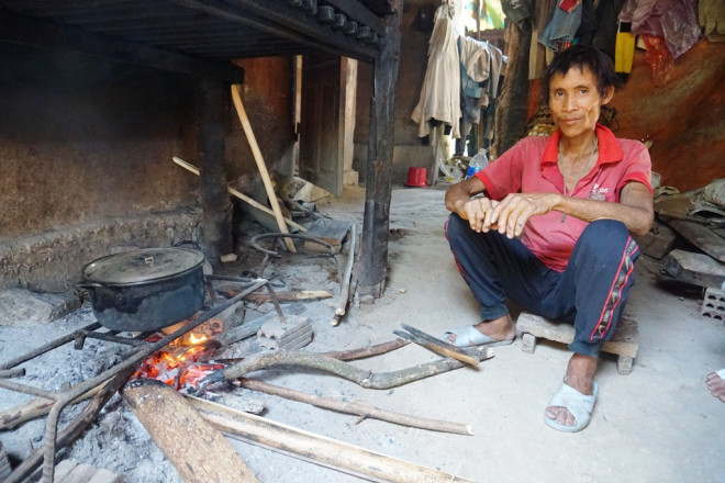 "Người rừng" Hồ Văn Lang suy kiệt vì bị ung thư giai đoạn cuối - 3