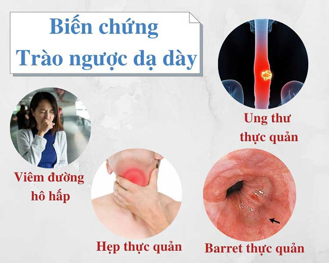 Chắc chắn bạn chưa hiểu hết về trào ngược dạ dày - Chuyên gia tư vấn cách thoát bệnh dễ dàng - 3