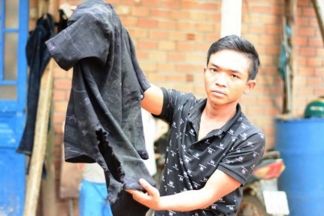 Người bám hông xe tải 20km sau tai nạn: "Xe dừng tôi mới tin mình còn sống"! - 2