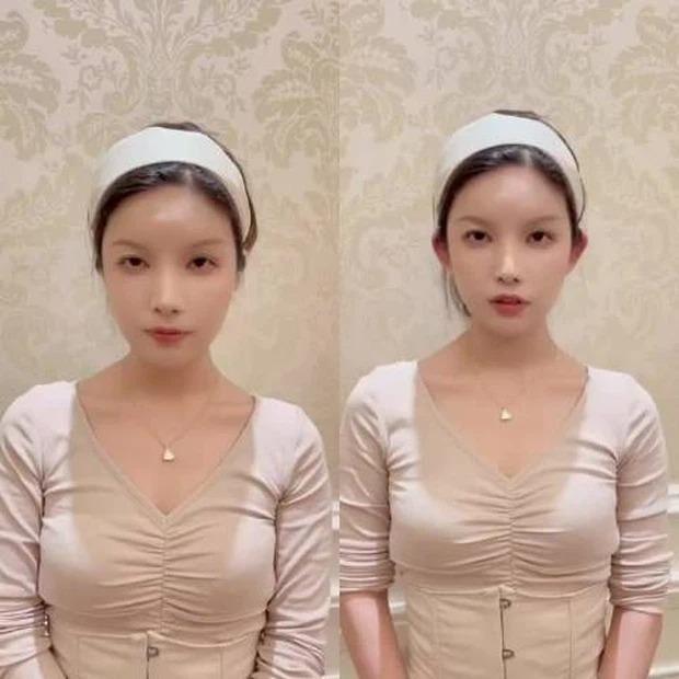'Sốc': Cận cảnh quá trình phẫu thuật để đôi tai vểnh như tai yêu tinh của các cô gái trẻ - 4