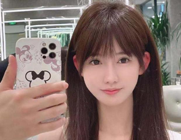 'Sốc': Cận cảnh quá trình phẫu thuật để đôi tai vểnh như tai yêu tinh của các cô gái trẻ - 5