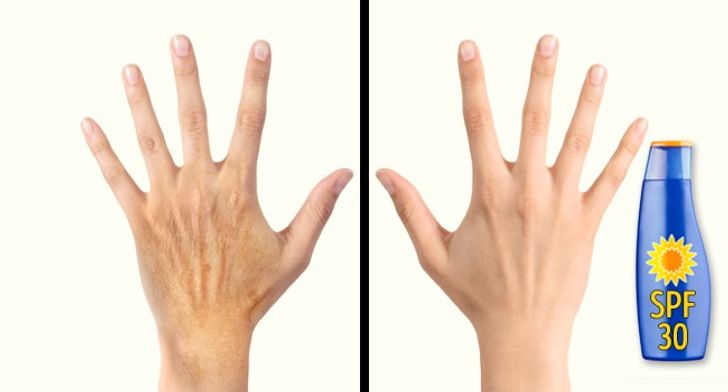 Cách chăm sóc bộ phận tố cáo tuổi tác rõ nhất trên cơ thể bạn - 4