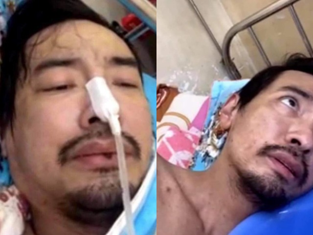 Lý do ca sĩ Việt Quang bị viêm phổi nặng, hốc hác khó nhận ra? - 1