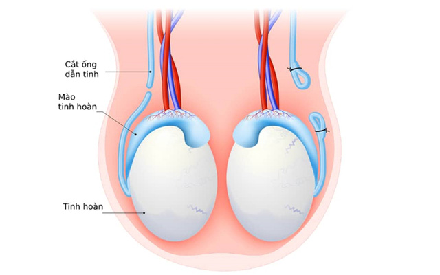 Ưu và nhược điểm của 10 biện pháp tránh thai hiện nay bạn nên biết - 8