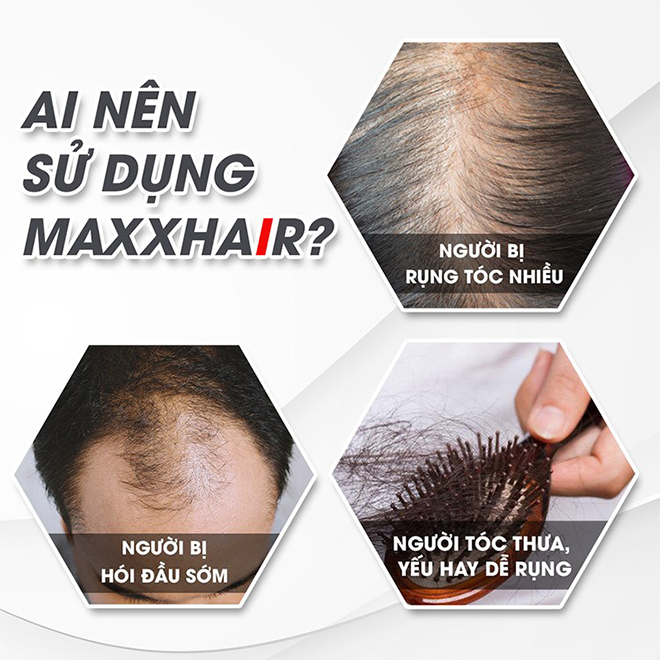 Cách giảm rụng tóc ngay tại nhà, chỉ 2 phút mỗi ngày không thử ngay thì quá tiếc - 4