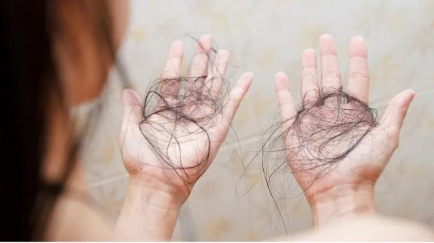 Rụng tóc, không phải lúc nào cũng đáng lo - 3