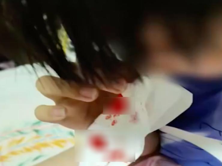 TQ: Hơn 100 trẻ chảy máu mũi bất thường, chính quyền nói gì?