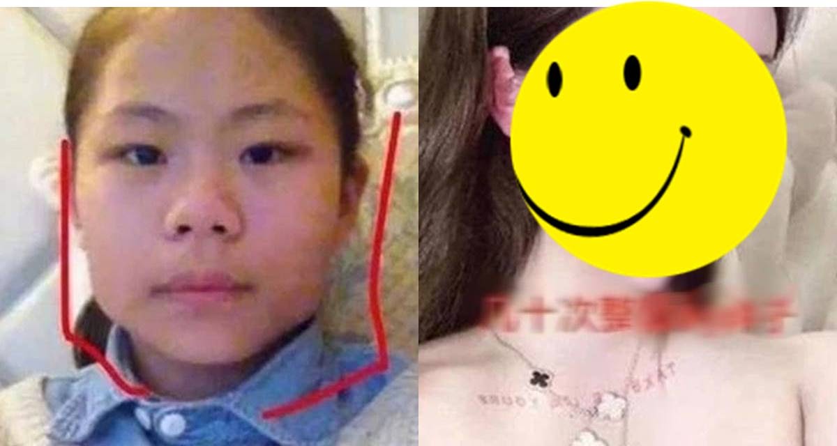 Bé gái 13, 14 tuổi ở Trung Quốc chi hàng chục tỷ đồng để &#34;dao kéo&#34; cả trăm lần - 6