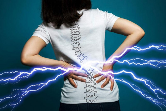 Tại sao phụ nữ luôn bị đau lưng? Đừng chủ quan với 8 nguyên nhân này! - 2