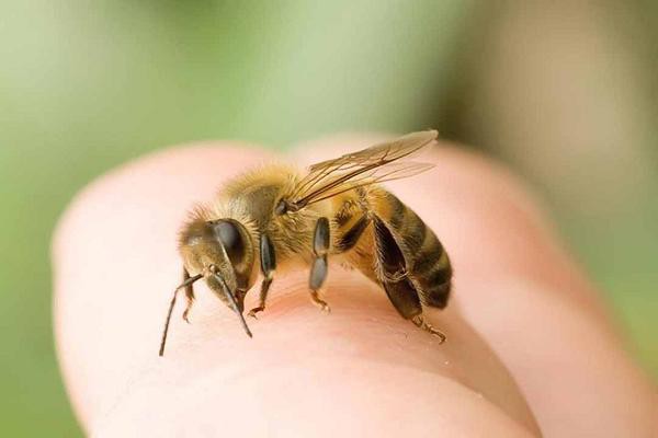 Ra vườn chơi, bé gái 18 tháng tuổi bị đàn ong mật đốt gần 50 nốt - 1