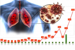 Virus đường hô hấp quay lại, chuyên gia chỉ rõ 3 lưu ý quan trọng cho người bệnh ho, đờm, khó thở
