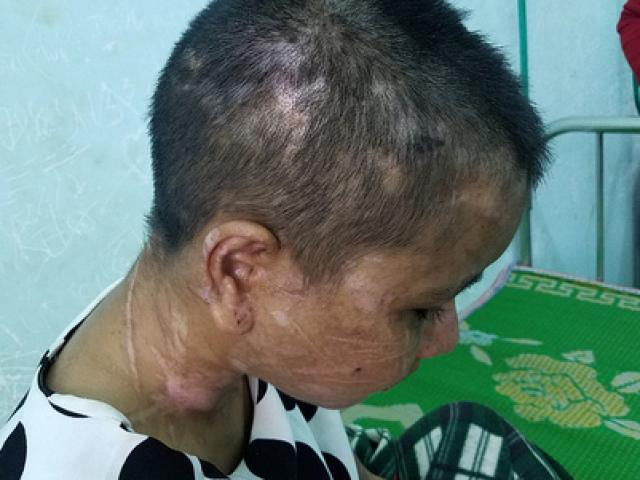TP HCM: Một thai phụ bị nhốt, tra tấn đến sảy thai 1532242699 532 thumbnail TP HCM: Một thai phụ bị nhốt, tra tấn đến sảy thai