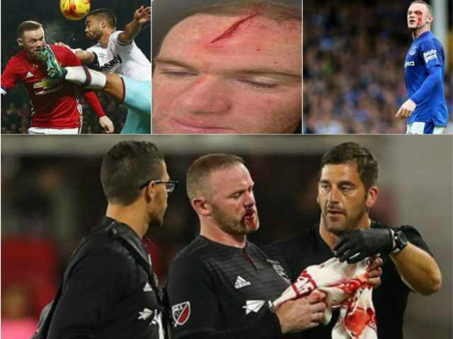 Rooney đổ máu khâu 5 mũi: Rực lửa nhuộm đỏ MLS, có phải giải nghệ sớm?