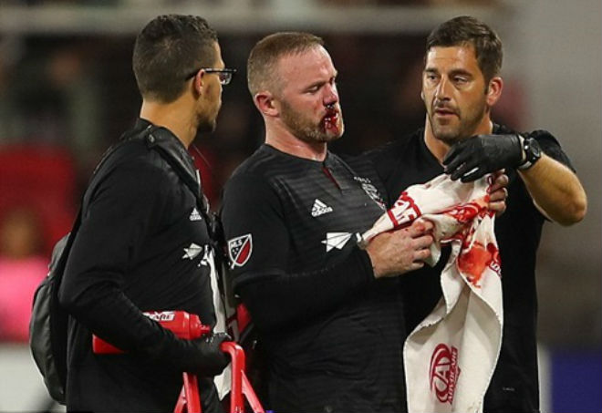 Rooney đổ máu khâu 5 mũi: Rực lửa nhuộm đỏ MLS, có phải giải nghệ sớm? - 1