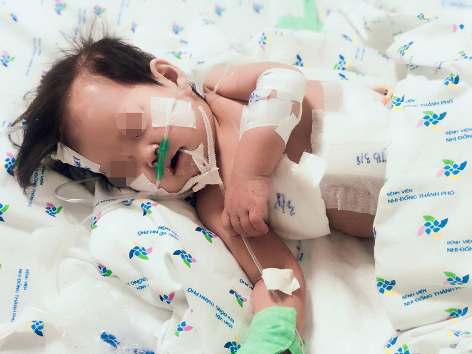 Sốc: Bé gái 10 tháng tuổi thủng thực quản, phổi kháng tất cả kháng sinh - 1