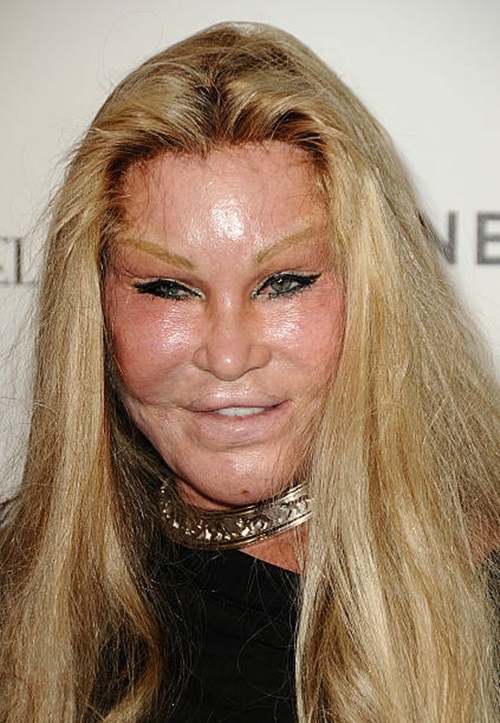 Jocelyn Wildenstein n t ph  nghin thm m  chiu ch ng