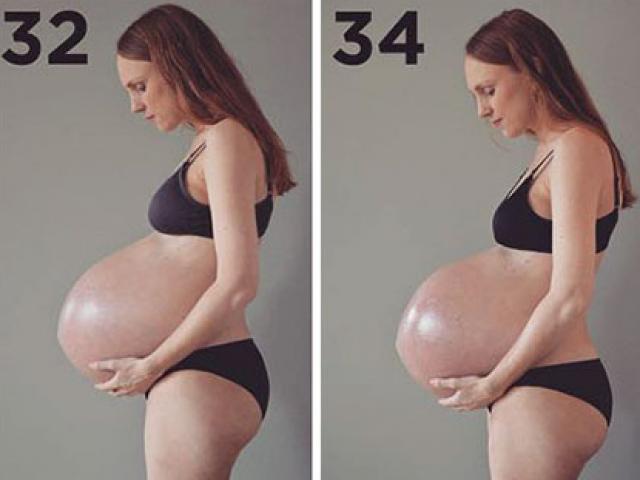 Mang thai 3 hiếm gặp, chúng ta phải gọi người mẹ này là siêu nhân