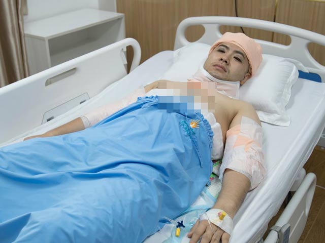 Hành trình giảm mỡ đầy khổ cực của Akira Phan
