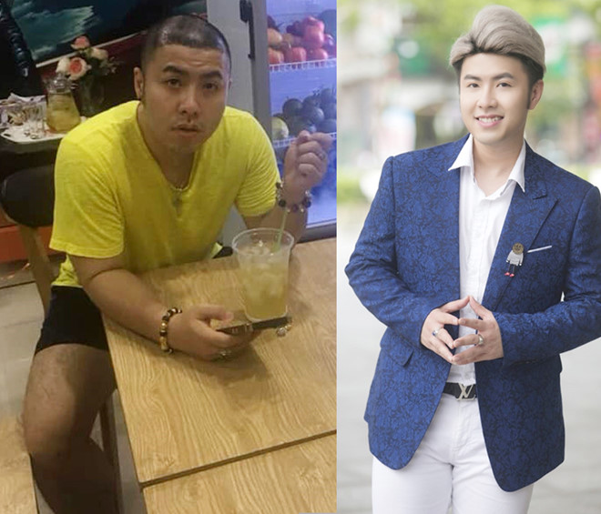 Việt Anh, Erik... sửa mặt đến khó ai nhận ra: Thời đại đàn ông "dao kéo" lên ngôi - 1