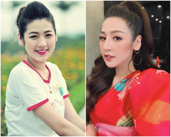 "Nghi vấn" á hậu Tú Anh chỉnh sửa mũi - 1