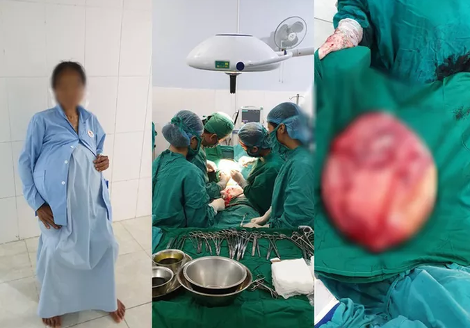 Cô giáo mầm non đeo &#34;bụng bầu&#34; nặng 25 kg suốt 14 năm - 1