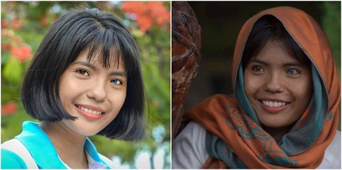 Cô gái Việt Nam xinh đẹp có đôi mắt hai màu: Căn bệnh hiếm gặp trên thế giới - 1